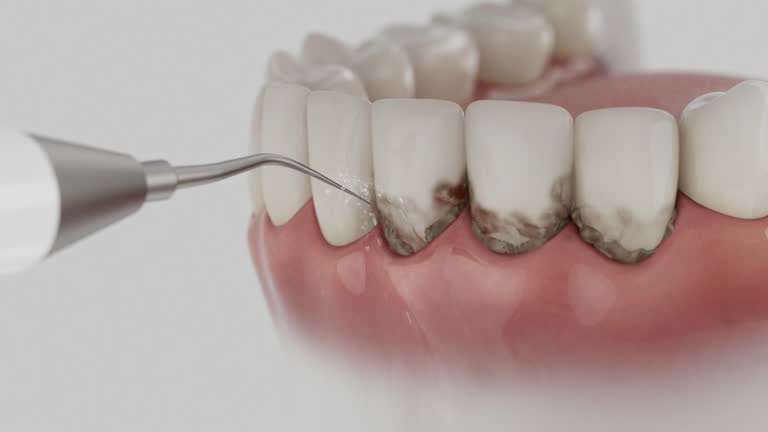 Reliable Dental contractor in Somerset, OH by Dentist Open Now